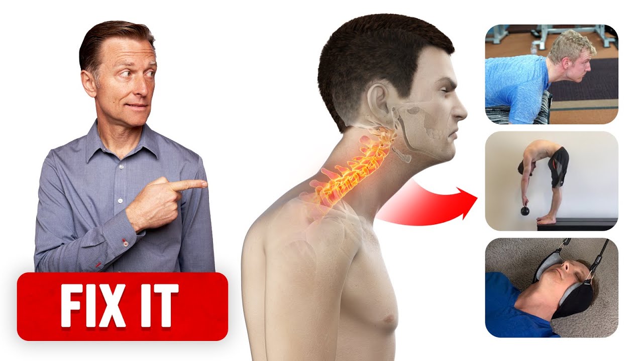 Forward Head Posture: The Hidden Dangers You Need to Know